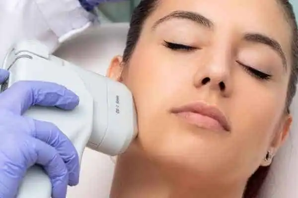 Image of woman having HIFU Newport treatment