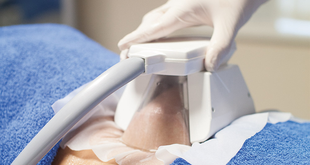 How Fat Freezing and HIFU Work Together? 2 Multiple Areas in One Session HIFU and Fat Freezing Newport