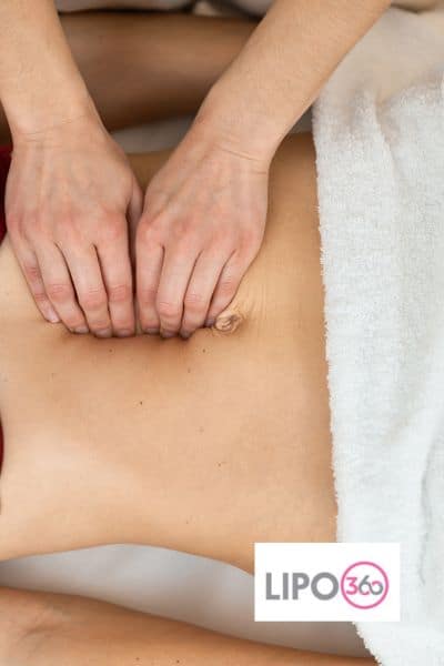 diastasis recti treatment Newport