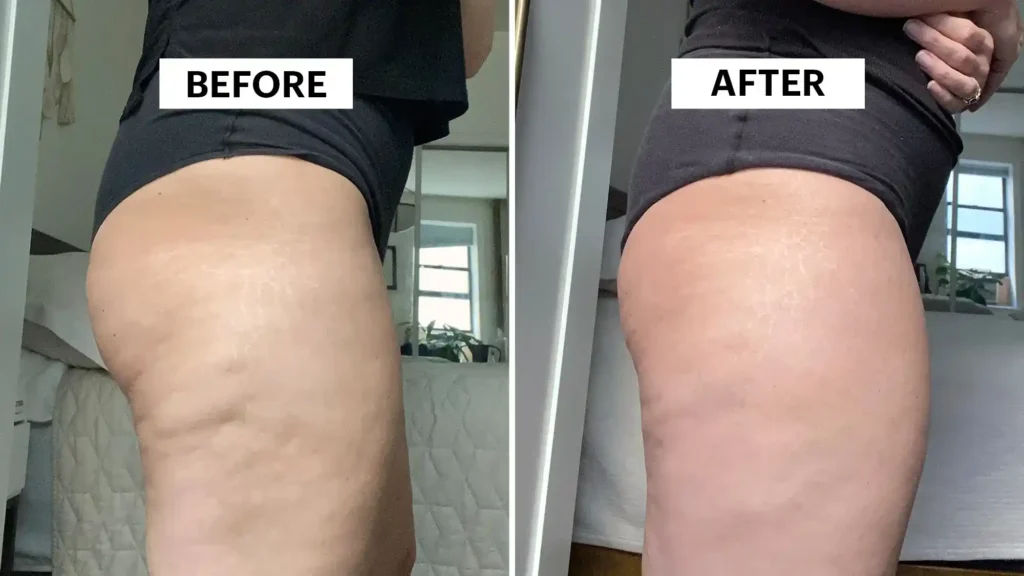 Do Toning Exercise Newport Really Tackle Cellulite?